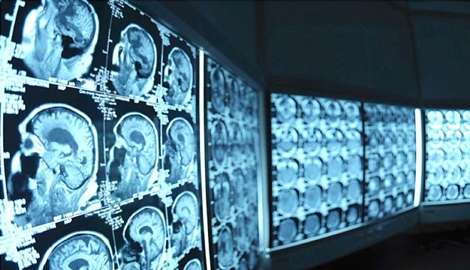 IBM Watson powered solutions to draw insight from medical imaging
